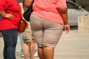 obese woman